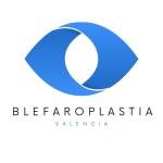 Blefaroplastia en Valencia